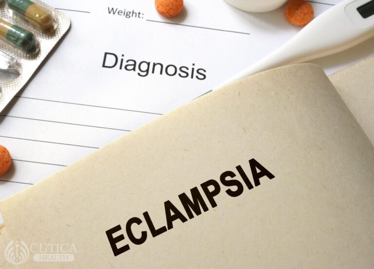 Eclampsia: When Blood Pressure Might Be Dangerous in Pregnancy