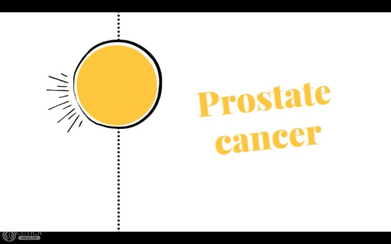 Prostate Cancer: What to Know