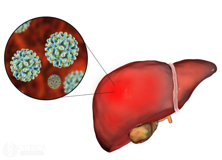 Hepatitis B: What you need to Know
