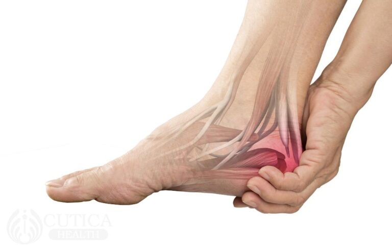 Heel pain: common causes and solutions