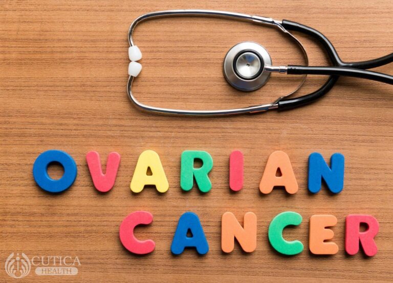Ovarian Cancer: What you Should Know